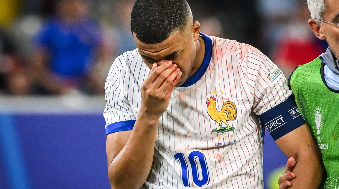 Kylian Mbappe Cidera Mengalami Benturan hidung di Euro 2024